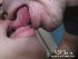 ����ץ����2